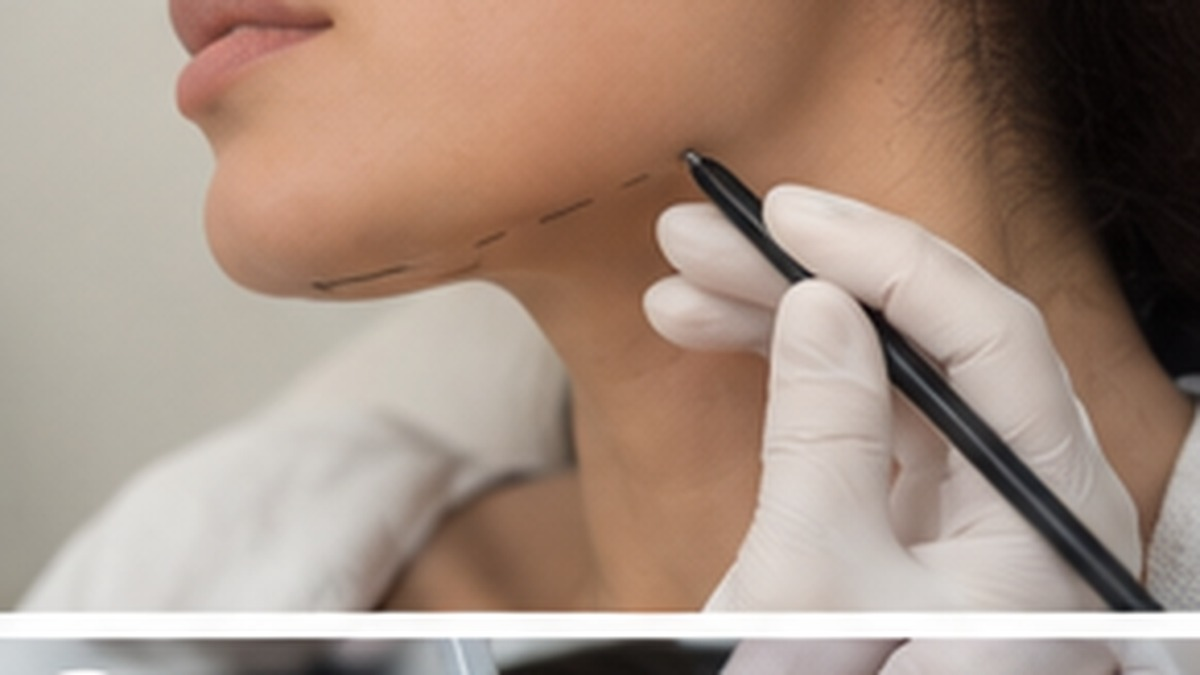 Illustration of double chin treatment options treatment