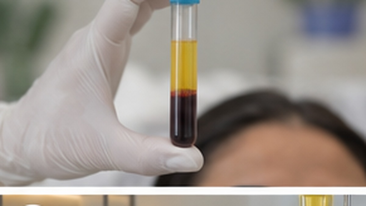 Illustration of prp for hair thinning treatment
