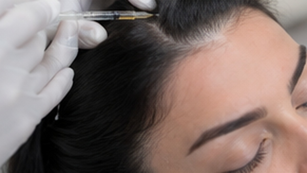 Illustration of hair mesotherapy treatment